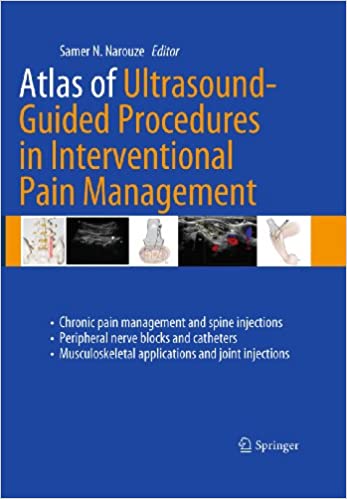 Atlas of Ultrasound-Guided Procedures in Interventional Pain Management ebook