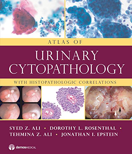 Atlas of Urinary Cytopathology ebook