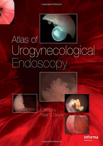 Atlas of Urogynecological Endoscopy ebook