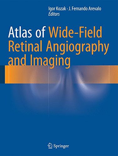 Atlas of Wide-Field Retinal Angiography and Imaging ebook