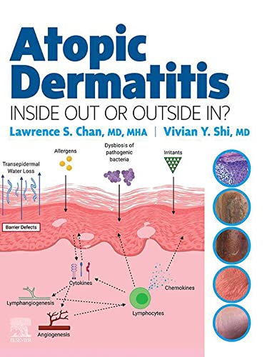 Atopic Dermatitis: Inside Out or Outside In, 1st Edition ebook