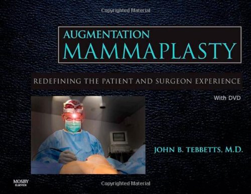 Augmentation Mammaplasty ebook