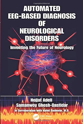 Automated EEG-Based Diagnosis of Neurological Disorders ebook