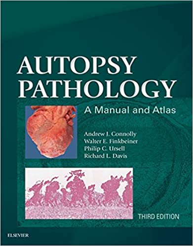 Autopsy Pathology: A Manual and Atlas ebook