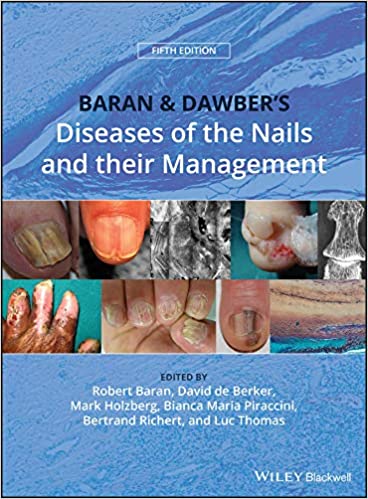 Baran and Dawber?s Diseases of the Nails and their Management (5th Edition) ? ebook