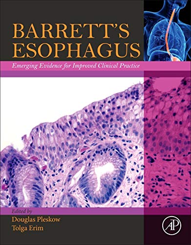 Barrett?s Esophagus ebook