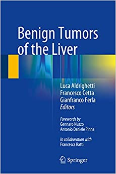 Benign Tumors of the Liver ebook