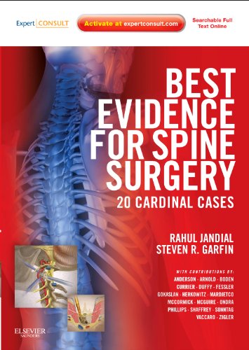 Best Evidence for Spine Surgery ebook