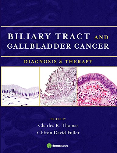 Biliary Tract and Gallbladder Cancer ebook