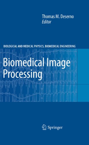 Biomedical Image Processing ebook