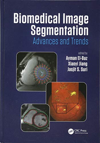 Biomedical Image Segmentation ebook