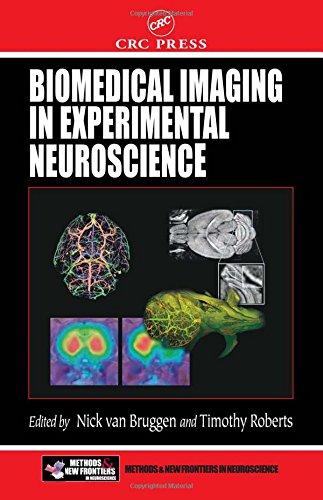 Biomedical Imaging in Experimental Neuroscience ebook