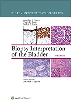 Biopsy Interpretation of the Bladder ebook