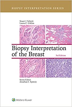 Biopsy Interpretation of the Breast (Biopsy Interpretation Series) ebook