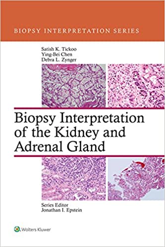 Biopsy Interpretation of the Kidney & Adrenal Gland (Biopsy Interpretation Series) ebook