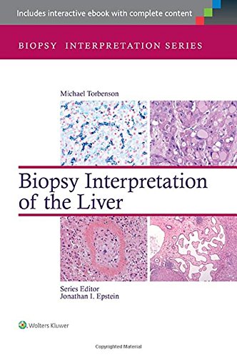 Biopsy Interpretation of the Liver ebook
