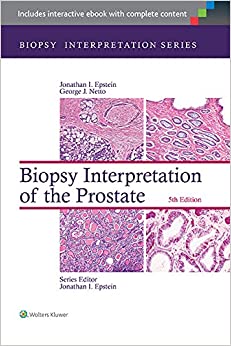 Biopsy Interpretation of the Prostate (Biopsy Interpretation Series) ebook