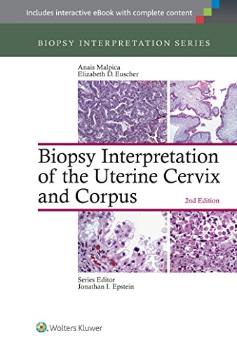 Biopsy Interpretation of the Uterine Cervix and Corpus ebook
