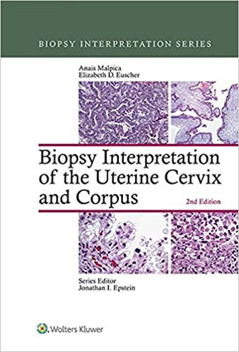 Biopsy Interpretation of the Uterine Cervix and Corpus (Biopsy Interpretation Series) ebook