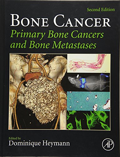Bone Cancer: Primary Bone Cancers and Bone Metastases ebook