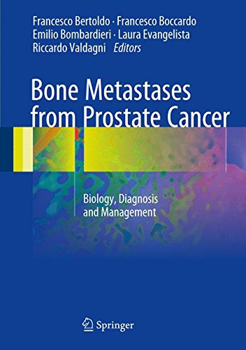 Bone Metastases from Prostate Cancer ebook