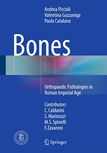 Bones ebook