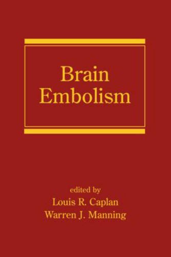 Brain Embolism ebook