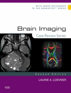 Brain Imaging Case Review Series 2nd Edition by Laurie A. Loevner ebook