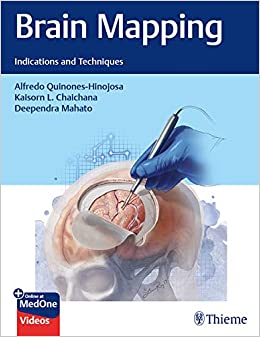 Brain Mapping: Indications and Techniques ebook