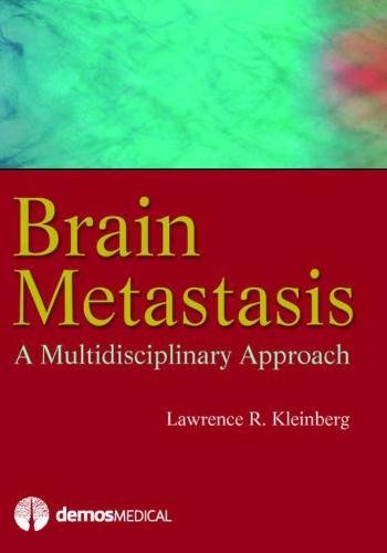 Brain Metastasis ebook