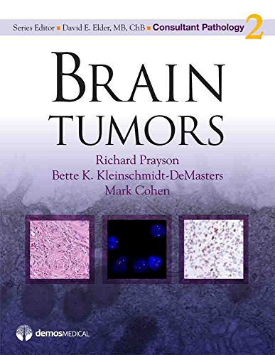 Brain Tumors ebook