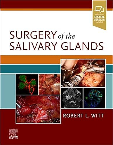 Surgery of the Salivary Glands, 1st Edition ebook