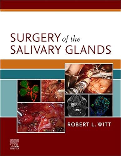 Surgery of the Salivary Glands, 1st Edition ebook