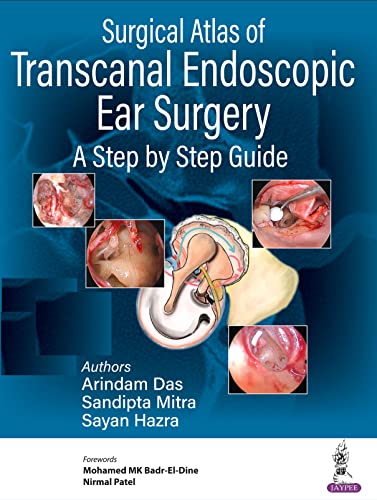 Surgical Atlas of Transcanal Endoscopic Ear Surgery: A Step by Step Guide ebook