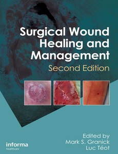 Surgical Wound Healing and Management 2nd Edition by Mark S. Granick ebook