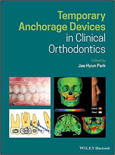 Temporary Anchorage Devices in Clinical Orthodontics ebook