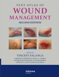 Text Atlas of Wound Management 2nd Edition by Vincent Falanga ebook
