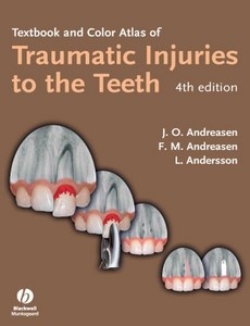 Textbook and Color Atlas of Traumatic Injuries to the Teeth 4th Edition by Jens O. Andreasen ebook