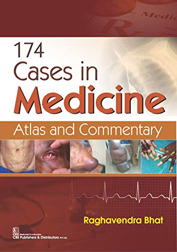The 174 cases in Medicine ebook