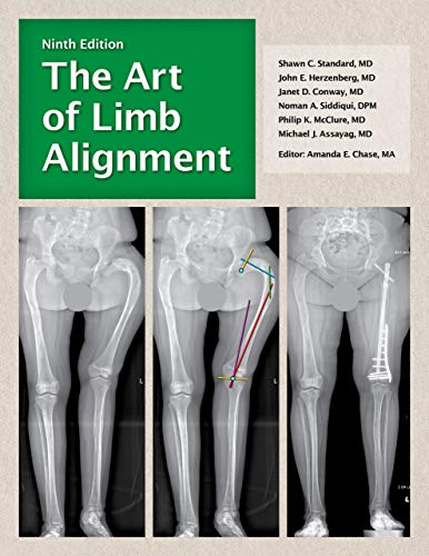 The Art of Limb Alignment, Ninth Edition ebook
