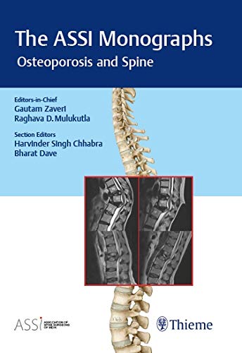 The ASSI Monographs : Osteoporosis And Spine ebook