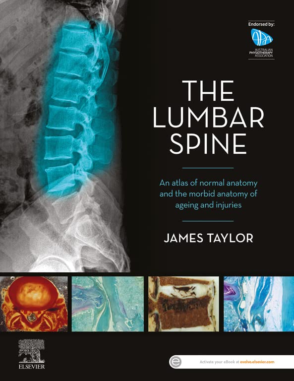 The Lumbar Spine: An Atlas of Normal Anatomy and the Morbid Anatomy of Ageing and Injury ebook
