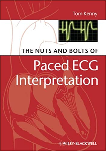 The Nuts and bolts of Paced ECG Interpretation ebook