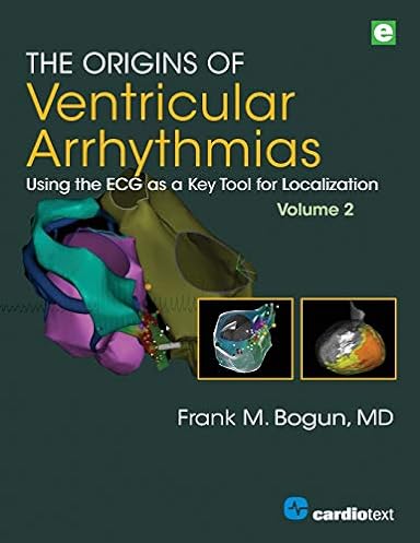 The Origins of Ventricular Arrhythmias: Using the ECG as a Key Tool for Localization, Volume 2 ebook