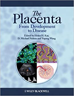The Placenta: From Development to Disease ebook