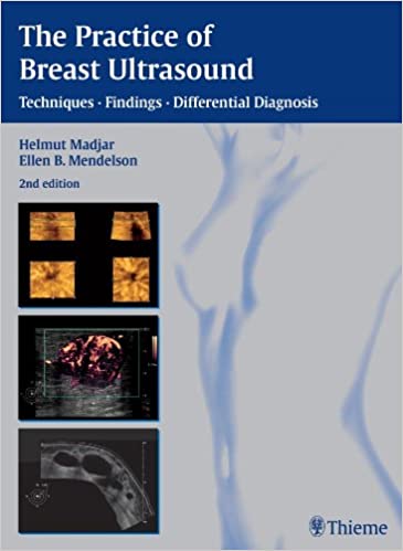 The Practice of Breast Ultrasound: Techniques, Findings, Differential Diagnosis ebook