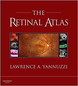 The Retinal Atlas, 1st Edition, 12-Month Access,: Expert Consult ebook