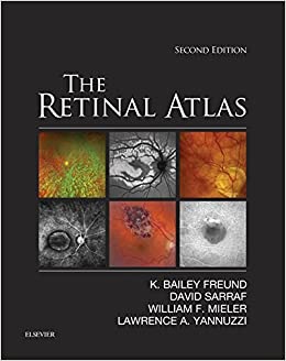 The Retinal Atlas ebook