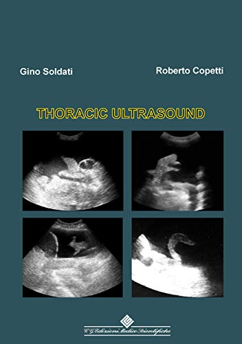 Thoracic Ultrasound ebook