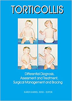 Torticollis: Differential Diagnosis, Assessment and Treatment, Surgical Management and Bracing (Monograph Published Simultaneously As Physical & Occupational Therapy in Pediatrics , Vol 17 No 2) ebook